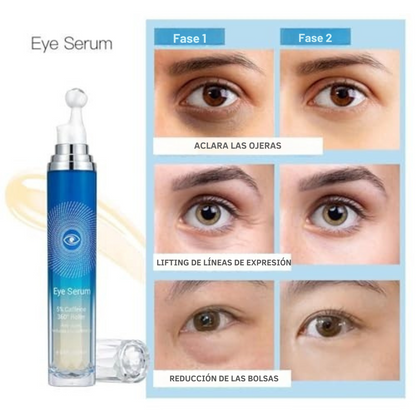 Rodillo Ojeras Rodillo Tratamiento Antiojeras (Serum EYES) – wutula