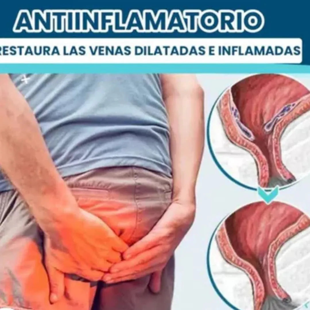 Gel Antihemorroides Natural™– Alivio Rápido y Efectivo (Tratamiento para Las Hemorroides)