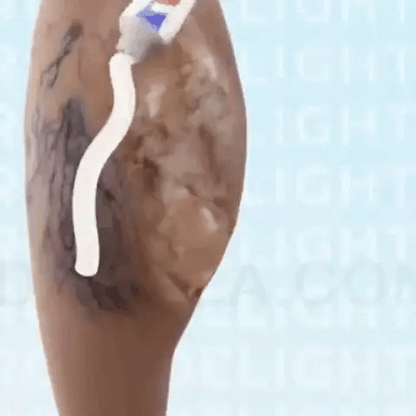 Crema para combatir las varices paga 1 lleva 2