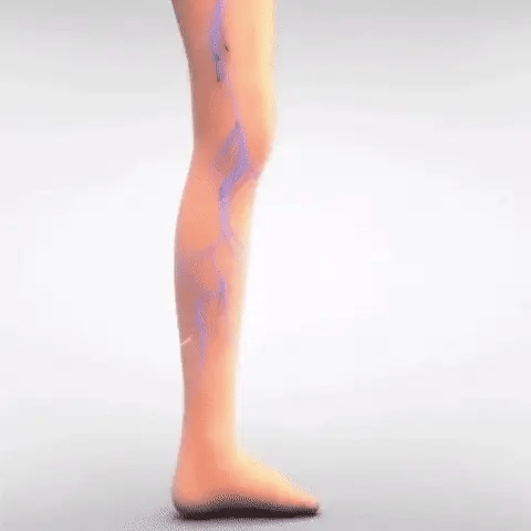 Crema para combatir las varices paga 1 lleva 2