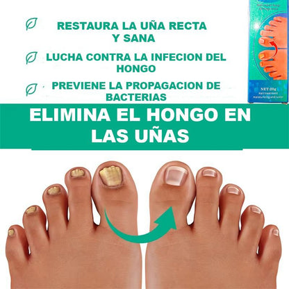 Crema para eliminar el hongo de las Uñas
