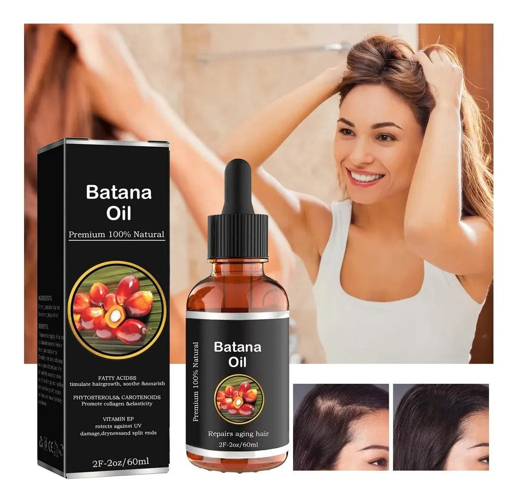 BATANA OIL PARA LA CAIDA DEL CABELLO