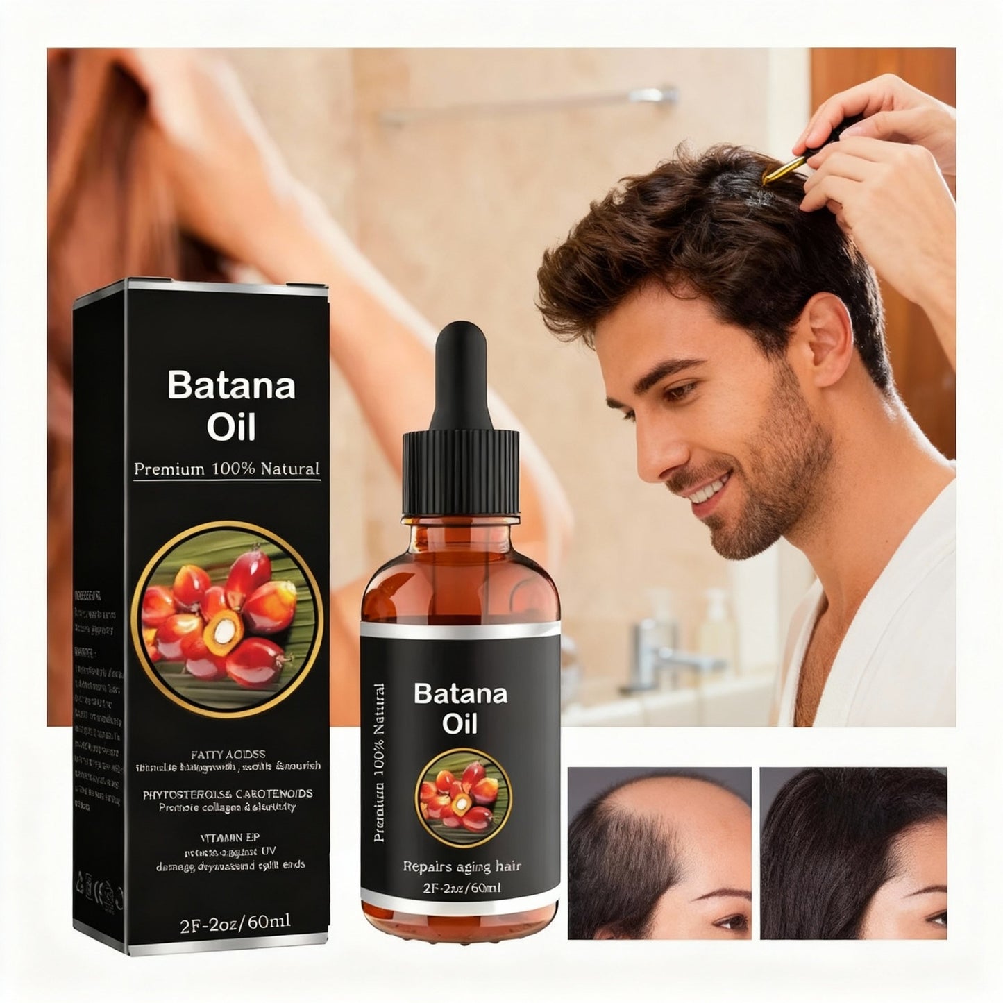 BATANA OIL PARA LA CAIDA DEL CABELLO